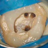 Endocactus MB2